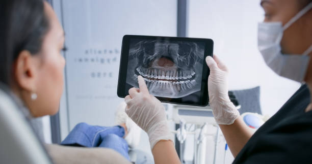 Licensed Teeth Cleaning And Checkup service in Port Hueneme, CA - Smile Center Dentistry